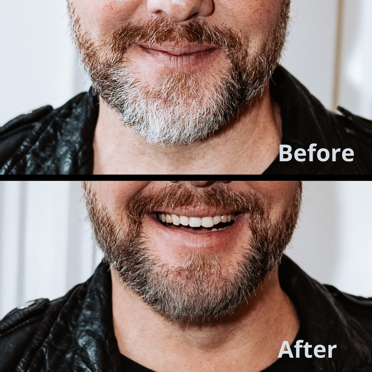 Before and after the use of beard filler